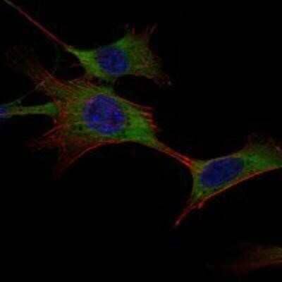 Immunocytochemistry/ Immunofluorescence: Hexokinase 1 Antibody (3A10) - BSA Free [NBP1-51644]