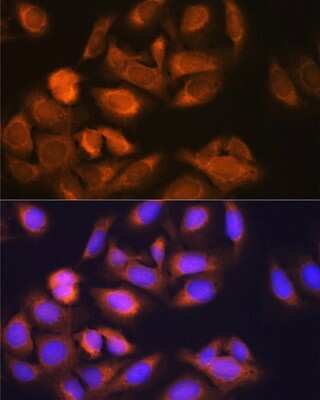 Immunocytochemistry/ Immunofluorescence: Hexokinase 1 Antibody (6B7Q2) [NBP3-15274]