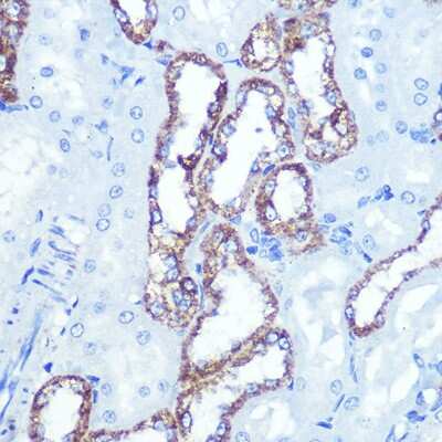 Immunohistochemistry-Paraffin: Hexokinase 1 Antibody (6B7Q2) [NBP3-15274]