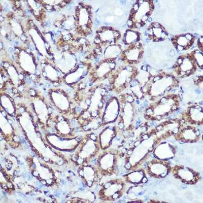 Immunohistochemistry-Paraffin: Hexokinase 1 Antibody (6B7Q2) [NBP3-15274]