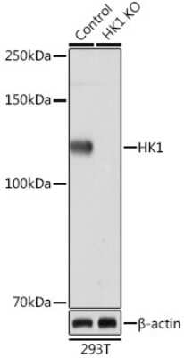 Knockout Validated: Hexokinase 1 Antibody (6B7Q2) [NBP3-15274]