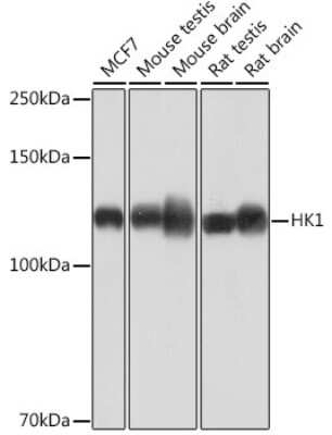 Western Blot: Hexokinase 1 Antibody (6B7Q2) [NBP3-15274]