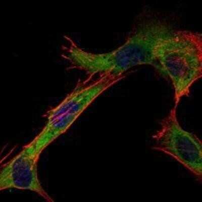 Immunocytochemistry/ Immunofluorescence: Hexokinase 1 Antibody (7A7) - BSA Free [NBP1-51639]