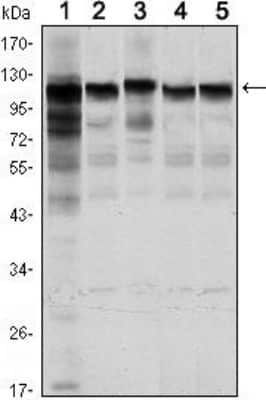 Western Blot: Hexokinase 1 Antibody (7A7)BSA Free [NBP1-51639]