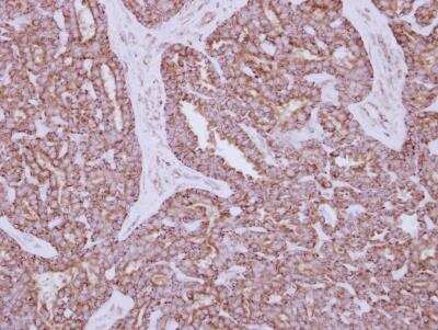 Immunohistochemistry-Paraffin: Hexokinase 1 Antibody [NBP1-31600]