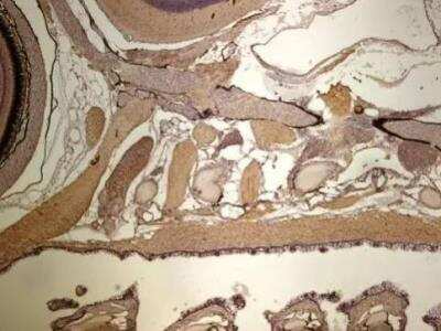 Immunohistochemistry-Paraffin: Hexokinase 1 Antibody [NBP1-31600]