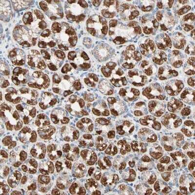 Immunohistochemistry-Paraffin: Hexokinase 1 Antibody [NBP1-85789]