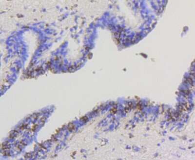 Immunohistochemistry-Paraffin: Hexokinase 1 Antibody (ST47-05) [NBP2-67503]