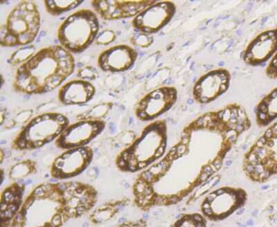 Immunohistochemistry-Paraffin: Hexokinase 1 Antibody (ST47-05) [NBP2-67503]