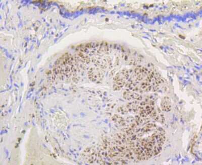 Immunohistochemistry-Paraffin: Hexokinase 1 Antibody (ST47-05) [NBP2-67503]