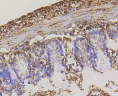 Immunohistochemistry-Paraffin: Hexokinase 1 Antibody (ST47-05) [NBP2-67503]