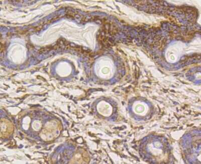 Immunohistochemistry-Paraffin: Hexokinase 1 Antibody (ST47-05) [NBP2-67503]