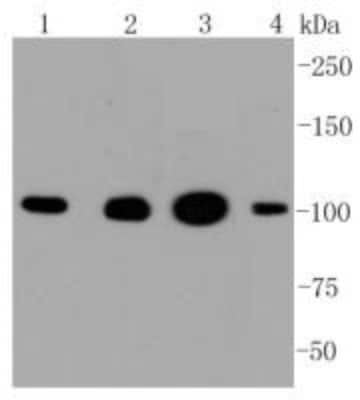 Western Blot: Hexokinase 1 Antibody (ST47-05) [NBP2-67503]