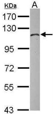 Western Blot: Hexokinase 1 Antibody [NBP1-31600]