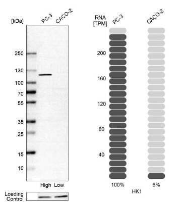 Western Blot: Hexokinase 1 Antibody [NBP1-85789]