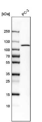 Western Blot: Hexokinase 1 Antibody [NBP1-87480]