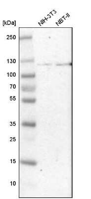 Western Blot: Hexokinase 1 Antibody [NBP1-87480]