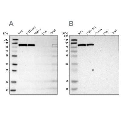 Western Blot: Hexokinase 1 Antibody [NBP1-87480]