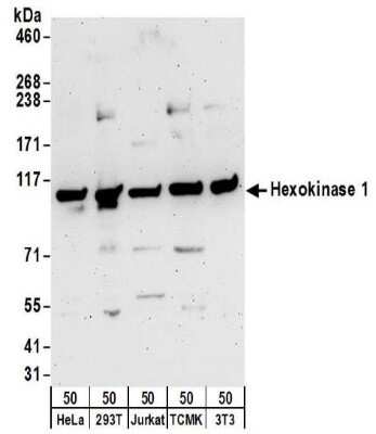 Western Blot: Hexokinase 1 Antibody [NBP2-32166]