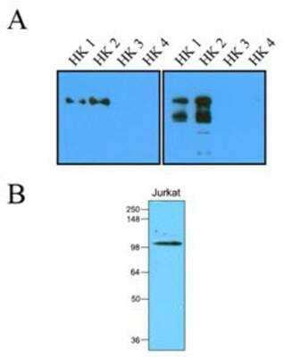 Western Blot: Hexokinase 2 Antibody (1A7)BSA Free [NBP1-04296]