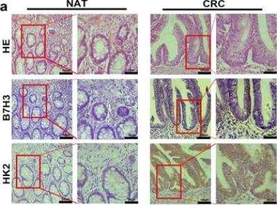 Immunohistochemistry: Hexokinase 2 Antibody (3D3) - BSA Free [NBP1-51643]