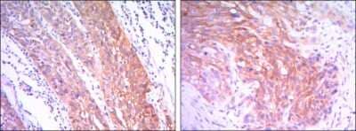 Immunohistochemistry-Paraffin: Hexokinase 2 Antibody (3D3) - BSA Free [NBP1-51643]