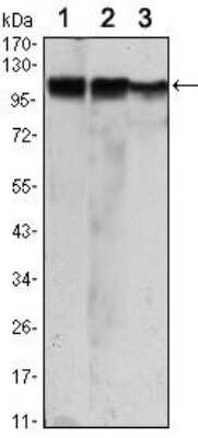 Western Blot: Hexokinase 2 Antibody (3D3)BSA Free [NBP1-51643]