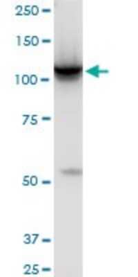 Western Blot: Hexokinase 2 Antibody (4H1) [H00003099-M01]
