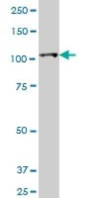 Western Blot: Hexokinase 2 Antibody (4H1) [H00003099-M01]