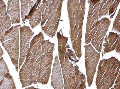 Immunohistochemistry-Paraffin: Hexokinase 2 Antibody [NBP2-16814]