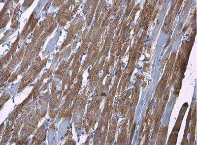 Immunohistochemistry-Paraffin: Hexokinase 2 Antibody [NBP2-16814]
