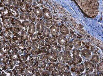 Immunohistochemistry-Paraffin: Hexokinase 2 Antibody [NBP2-16814]