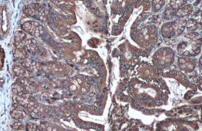 Immunohistochemistry-Paraffin: Hexokinase 2 Antibody [NBP2-16814]