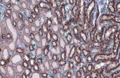 Immunohistochemistry-Paraffin: Hexokinase 2 Antibody [NBP2-16814]