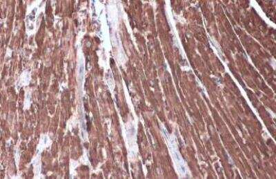 Immunohistochemistry-Paraffin: Hexokinase 2 Antibody [NBP2-16814]