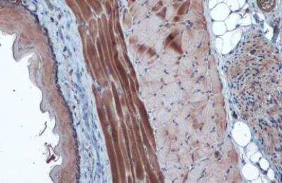 Immunohistochemistry-Paraffin: Hexokinase 2 Antibody [NBP2-16814]