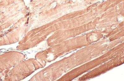 Immunohistochemistry-Paraffin: Hexokinase 2 Antibody [NBP2-16814]