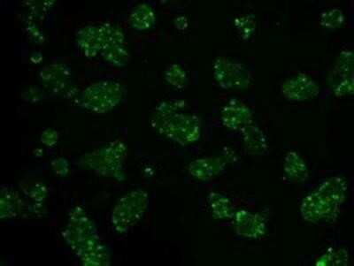 Flow Cytometry: Hexokinase 2 Antibody (OTI4C5) - Azide and BSA Free [NBP2-70891]