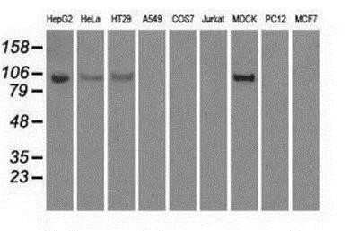 Western Blot: Hexokinase 2 Antibody (OTI4C5)Azide and BSA Free [NBP2-70891]