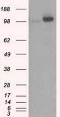 Western Blot: Hexokinase 2 Antibody (OTI4C5)Azide and BSA Free [NBP2-70891]