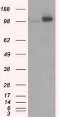 Western Blot: Hexokinase 2 Antibody (OTI4C5) [NBP2-02272]