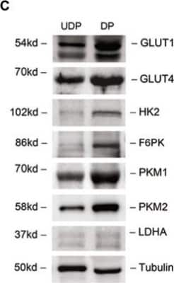 Western Blot: Hexokinase 2 Antibody (OTI4C5) [NBP2-02272]