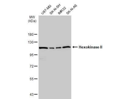 Western Blot: Hexokinase 2 Antibody [NBP2-16814]