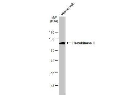 Western Blot: Hexokinase 2 Antibody [NBP2-16814]