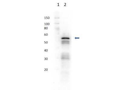 Western Blot: Hexokinase 2 Antibody [NBP2-44234]