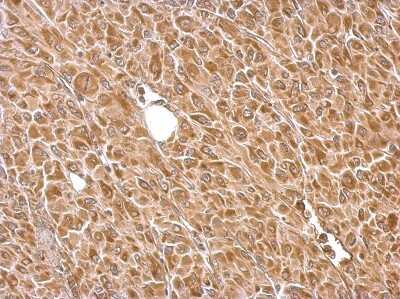 Immunohistochemistry-Paraffin: Hexokinase 2 Antibody [NBP2-16814]