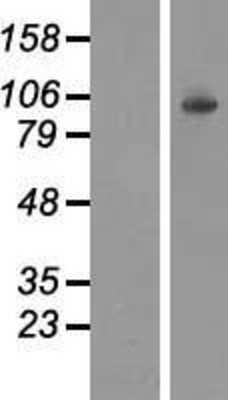 Western Blot: Hexokinase 1 Overexpression Lysate [NBL1-11578]