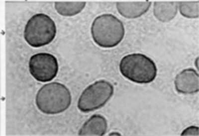 Immunocytochemistry/ Immunofluorescence: Hexokinase Type III Antibody (C7C3) [NBP2-29795]