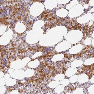 Immunohistochemistry-Paraffin: Hexokinase Type III Antibody [NBP2-38799]