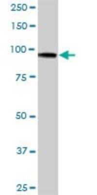 Western Blot: Hexokinase Type III Antibody [H00003101-B01P]